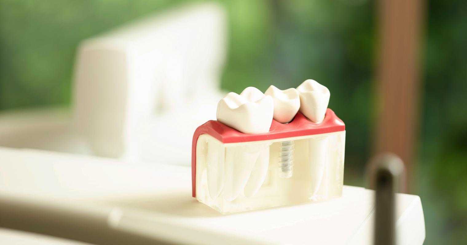 zahnkieferzentrum_0050